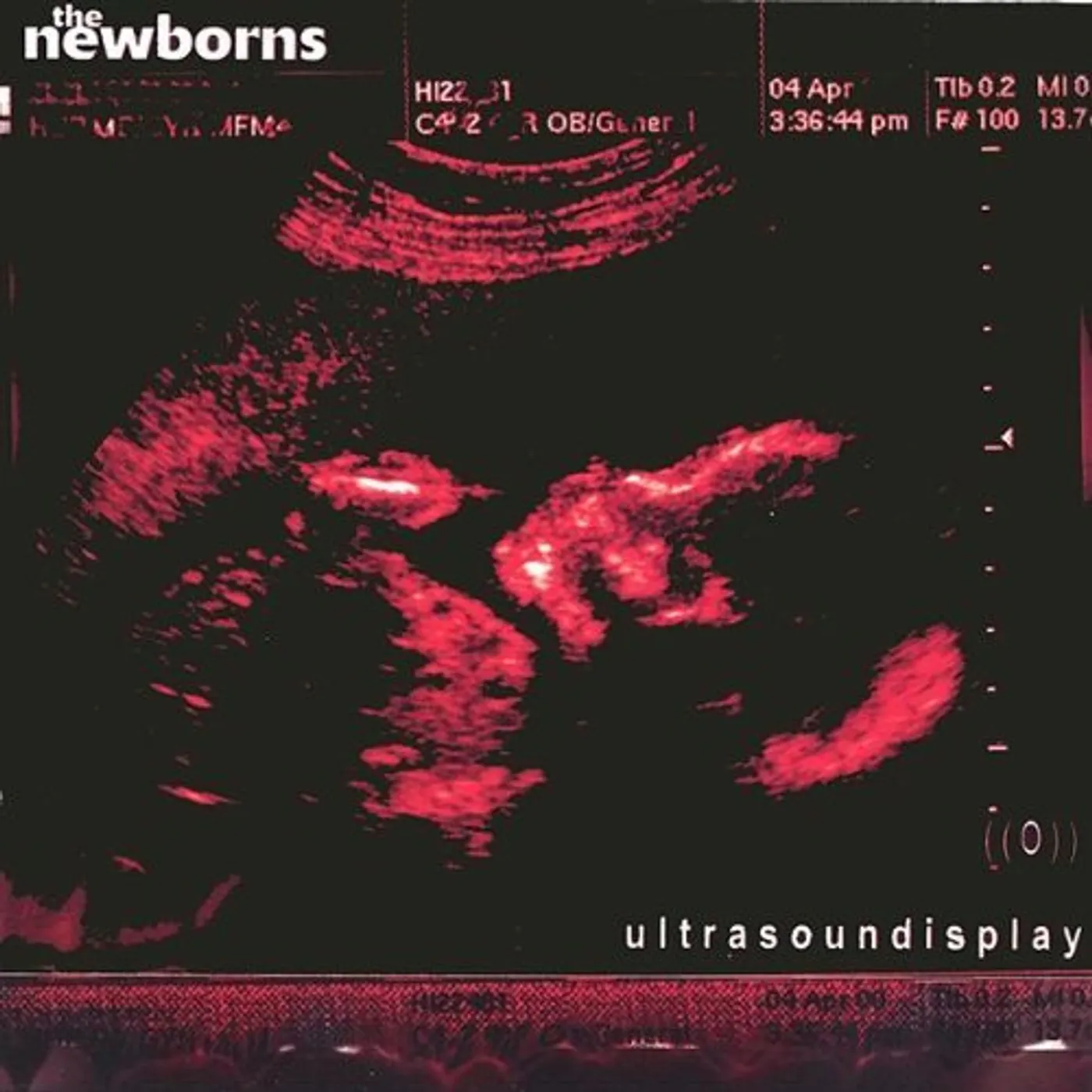Newborns ULTRASOUNDISPLAY CD