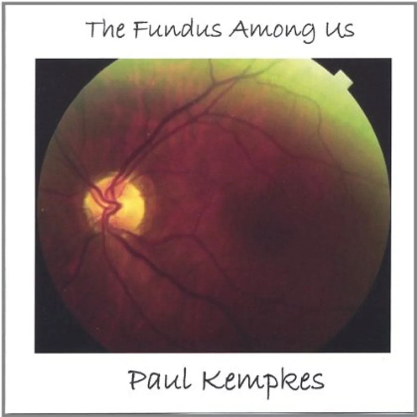 Paul Kempkes FUNDUS AMONG US CD