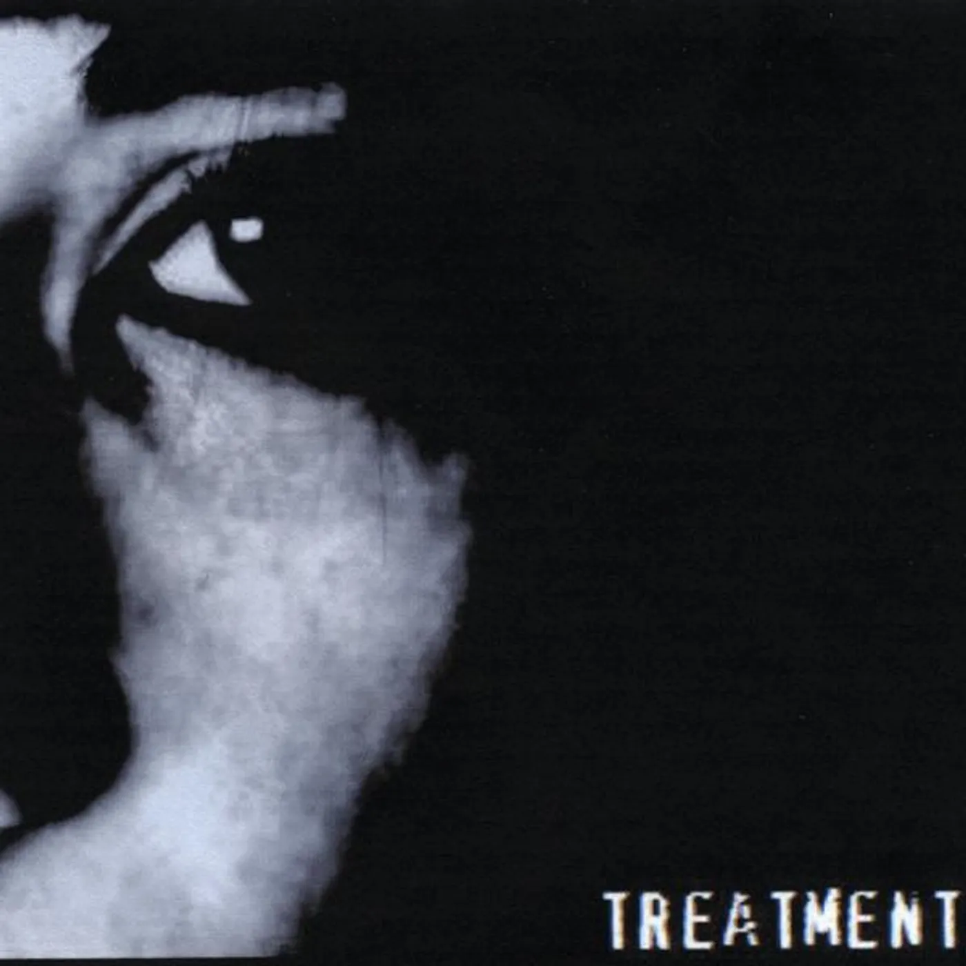 The Treatment MENTALMENTALITY CD