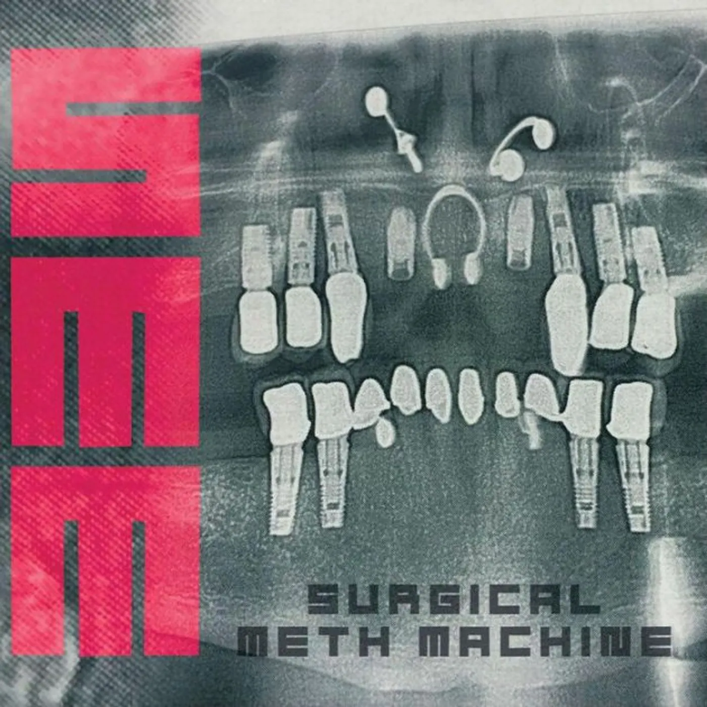 SURGICAL METH MACHINE CD